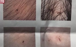 Vụ trẻ mẫu giáo có vết kim đâm kỳ lạ: Cảnh sát bắt được 3 cô giáo tàn độc, hiệu trưởng trường mẫu giáo bị cách chức