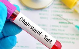 Cứ 10 người Việt trưởng thành thì có đến 3 người thừa cholesterol, nguyên nhân do đâu?