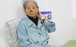 KỲ TÍCH: Cụ bà cao tuổi nhất Việt Nam bị nhồi máu cơ tim may mắn được cứu sống