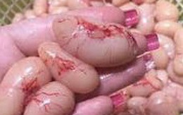 Thâm nhập cơ sở cung cấp kê gà tây