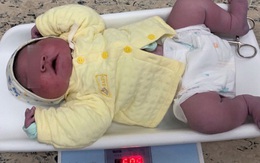 Hy hữu: Bé trai ở Hà Nội vừa chào đời đã nặng gần 6kg