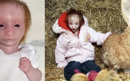 Bé gái chào đời chỉ nặng 30g, bác sĩ tuyên bố chỉ sống được 1 năm nhưng em đã chứng minh cho thế giới thấy phép màu là có thật!