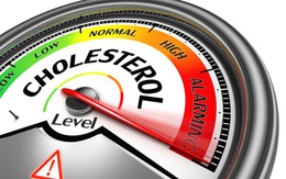 Mức cholesterol nên là bao nhiêu với mỗi độ tuổi?