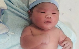 Sản phụ ở Khánh Hòa sinh bé trai nặng 6,5 kg