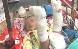 Làm giấy khai sinh cho bé 4 tháng bị bố đánh gãy chân: Mang họ mẹ, tên cha để trống
