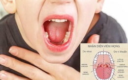 Cách bảo vệ họng cho trẻ, tránh nhiễm bệnh