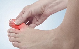Kỳ diệu vuốt ngón chân cái giúp chữa nhiều bệnh hay gặp