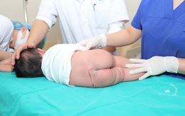 HIẾM: Cắt bỏ dị tật còn đuôi bẩm sinh ở bệnh nhi 5 tháng tuổi