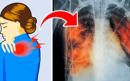 Có 5 dấu hiệu này chứng tỏ phổi của bạn đang "kêu cứu", tuyệt đối không được chủ quan
