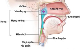 Mách bạn một số dấu hiệu cảnh báo ung thư tai mũi họng