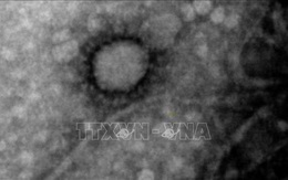 Phát hiện triệu chứng 'ngón chân SARS-CoV-2'