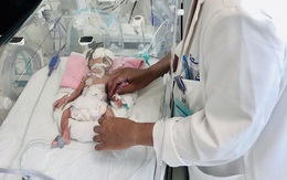 Phẫu thuật cứu bé gái sinh non nặng 1,2 kg bị teo ruột bẩm sinh