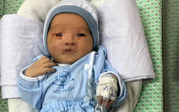 Bị nhiễm trùng máu, bé sơ sinh bị bỏ rơi dưới hố ga ở Hà Nội phải thở máy