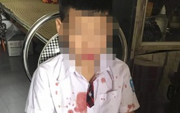 Vụ phụ huynh đánh HS lớp 1 nhập viện ở Hoà Bình: Cả hai đứa trẻ đều bị tổn thương tâm lý