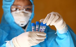 Việt Nam ghi nhận thêm 37 ca mắc COVID-19, 3 người ở TP HCM