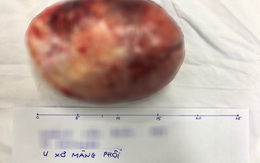 Phát hiện khối u hiếm trong lồng ngực sau 2 tháng nhói đau khi nằm nghiêng