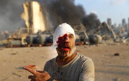 Hình ảnh thảm khốc đẫm máu trong vụ nổ thảm khốc ở Lebanon: Phụ nữ la hét, người lính gục khóc tại chỗ