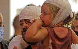 300.000 người vô gia cư sau vụ nổ Lebanon