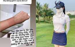 Huyền My bật mí cách cải thiện da cháy nắng