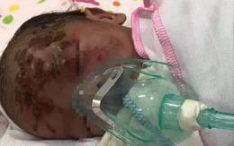 Yên Bái: Đau xót bé sơ sinh bị bỏ rơi ở ven đường có nhiều vết xước trên mặt