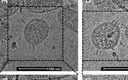 Ảnh hiển vi đầu tiên cho thấy hình dạng thật của virus corona