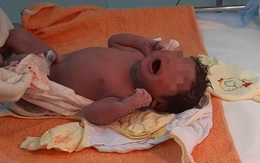 12 y - bác sĩ cấp tốc đến khu cách ly giúp sản phụ sinh con