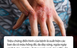 Chuyên gia da liễu tiết lộ 3 bệnh về da thường gặp vào mùa đông, muốn phòng tránh phải làm đủ 10 điều quan trọng