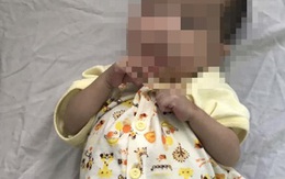 Căn bệnh khiến bé trai 7 tháng tuổi nhỏ như trẻ sơ sinh