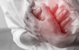 3 đặc điểm nhận biết bệnh nhồi máu cơ tim và 4 kiểu người tốt nhất nên đi kiểm tra