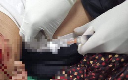 Nghịch pháo, 2 anh em bị thương nát tay, rách mặt