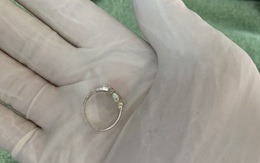 Bé gái 8 tuổi nuốt phải chiếc nhẫn của mẹ