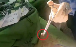 Thanh niên bị đầu đạn xuyên thủng bụng