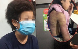 Bé gái 12 tuổi ở Hà Nội bị "cha dượng” hiếp dâm, mẹ đẻ hành hạ giờ ra sao?