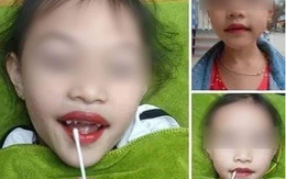 Từ vụ bé 5 tuổi xăm môi, chuyên gia cảnh báo những hệ lụy khó lường tuyệt đối không nên chủ quan!