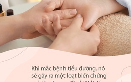 Tê tay tuy là chuyện thường nhưng hãy cẩn thận, nó cũng là dấu hiệu cảnh báo sớm của 5 loại bệnh "chết người" sau