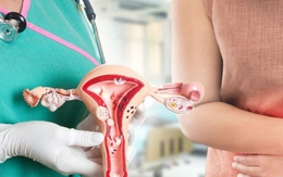 5 dấu hiệu bệnh nan y dễ gây nhầm lẫn ở phụ nữ, nếu thấy thì phải đi khám ngay