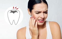 Tuổi mới 30 mà răng “yếu” như người 60: Áp dụng ngay '6 không 4 nên' này để cải thiện sức khoẻ răng miệng của bạn, đập tan nỗi lo lúc về già