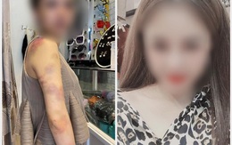Bị tố bạo hành vợ xuyên đêm ở Yên Bái, người chồng lên tiếng: Có tát, đấm vào đầu và vai nhưng không nhốt, đánh bằng gậy sắt