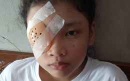 Nữ sinh 12 tuổi vỡ mạch máu mắt vì nhìn màn hình điện thoại 8 tiếng mỗi ngày trong thời gian dài