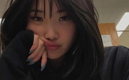 5 bất thường ở môi cảnh báo nhiều loại bệnh tật nguy hiểm nhưng ít người biết