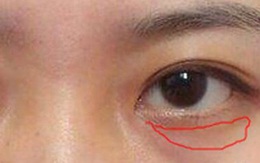 4 biểu hiện trên khuôn mặt cho thấy nữ giới đang mắc bệnh phụ khoa, chỉ cần phát hiện ra 1 cái cũng cần đi khám ngay