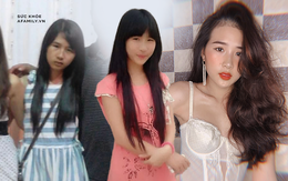 Cô gái bị méo miệng, liệt nửa mặt vì một thói quen ăn uống hàng triệu người trẻ đang có, ngoại hình sau khi can thiệp thẩm mỹ thực sự đáng kinh ngạc