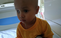 Xót xa bé trai 2 tuổi đôi mắt mất dần ánh sáng vì ung thư