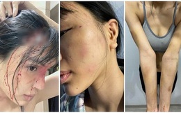 Vụ nữ siêu mẫu Khả Trang nghi bị giam lỏng và bạo hành dã man: Người chồng bị tố có thể phải đối mặt hình phạt nào?