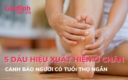 5 dấu hiệu xuất hiện ở bàn chân cảnh báo người tuổi thọ ngắn