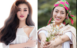 Miss World Việt Nam 2022 có thể phẫu thuật thẩm mỹ