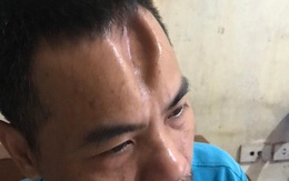 Dùng cào sắt đánh lún sọ, dập não hàng xóm đang phơi thóc