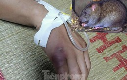 Suýt mất mạng vì sốt hạch nghi chuột rừng cắn