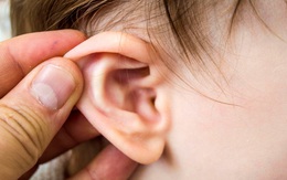 Cách lấy ráy tai cực kì nguy hiểm mà nhiều người vẫn hay làm