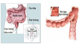 7 dấu hiệu nhận biết ung thư có thể tự kiểm tra